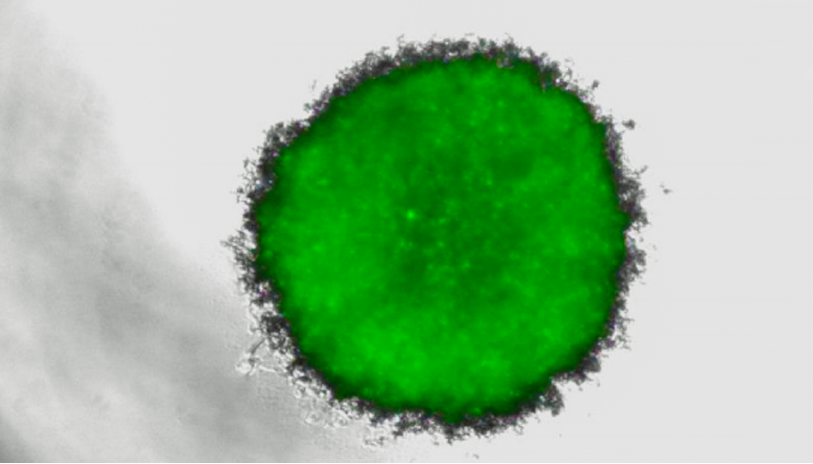 9-factors-to-consider-for-designing-and-optimizing-assays-for-3d-cultures